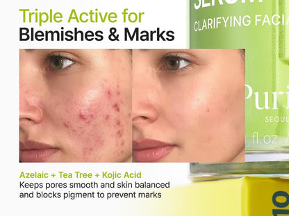 PURITO Azelaic Acid 10 Kojic Teatree Serum 30ml