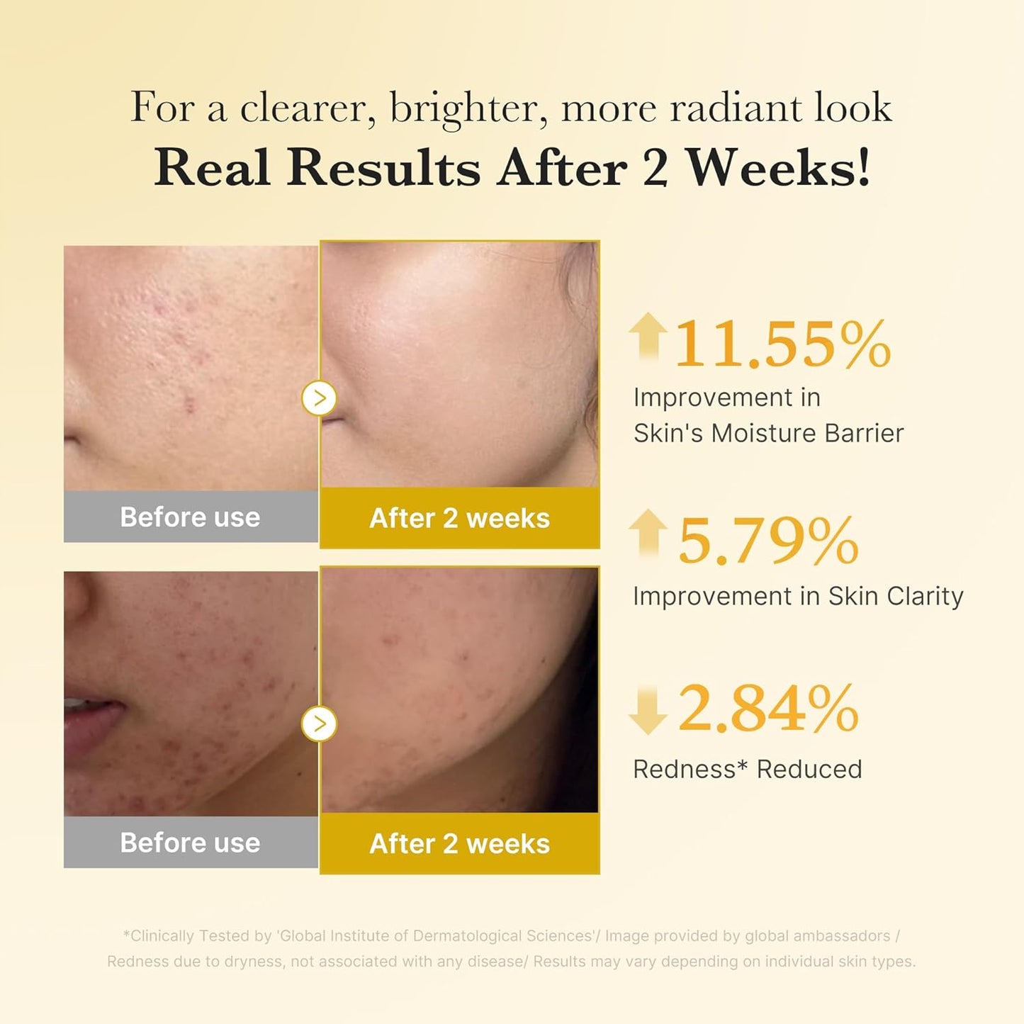 MEDICUBE Kojic Acid Turmeric Niacinamide Serum - Glam Secret