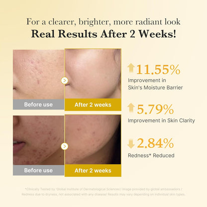 MEDICUBE Kojic Acid Turmeric Niacinamide Serum - Glam Secret
