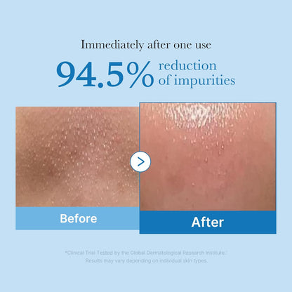 MEDICUBE Zero Pore Blackhead Deep Cleansing Oil - Glam Secret