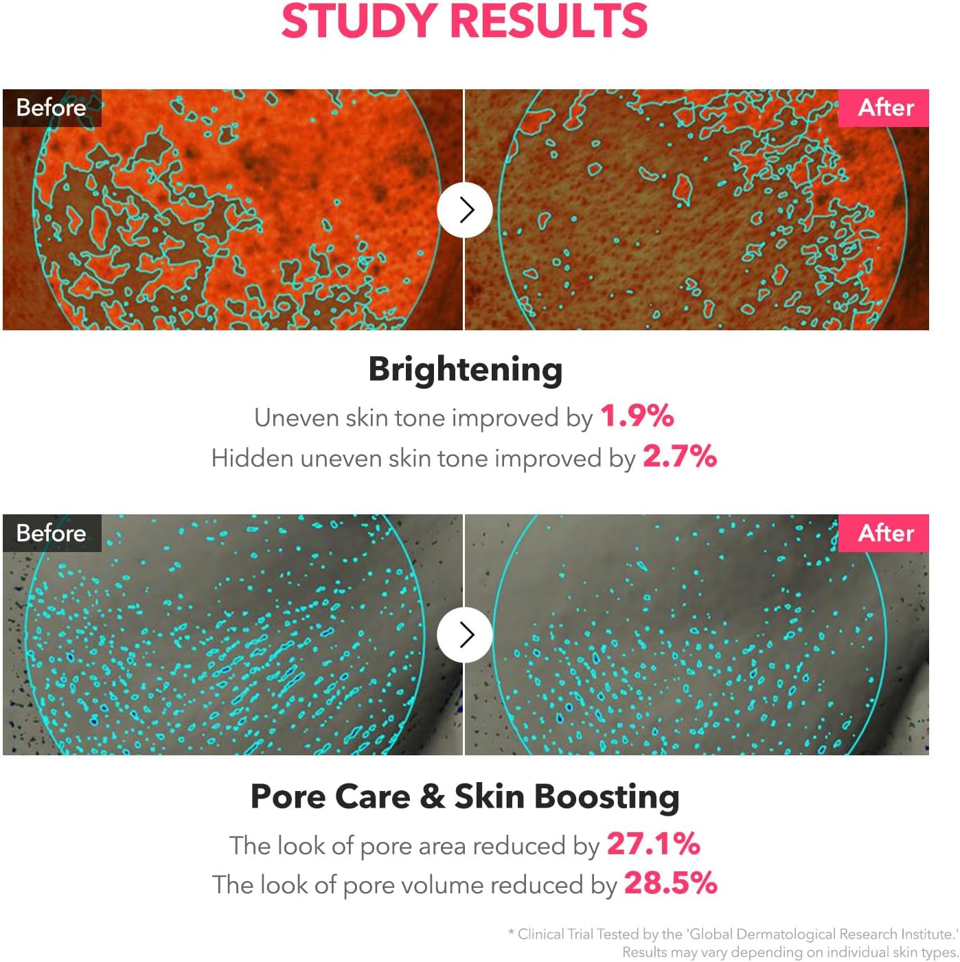 APRILSKIN TXA Niacinamide Toning Shot 99 Spicule Facial Serum - Glam Secret