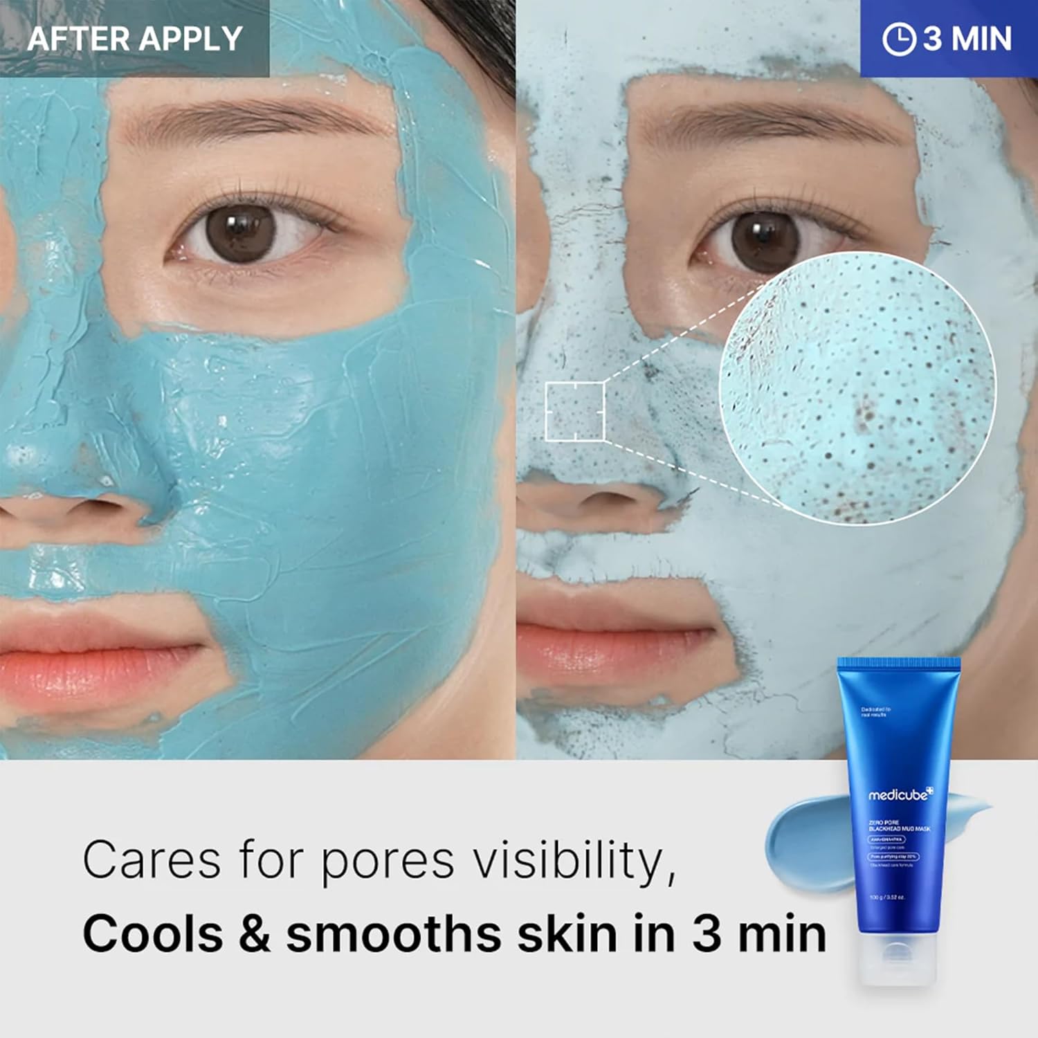 MEDICUBE Zero Pore Blackhead Mud Mask - Glam Secret