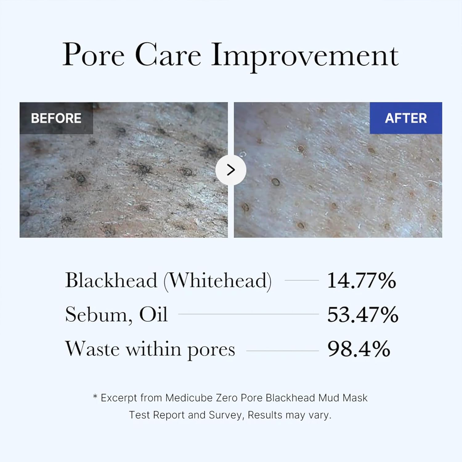 MEDICUBE Zero Pore Blackhead Mud Mask - Glam Secret