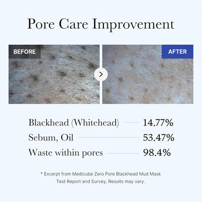 MEDICUBE Zero Pore Blackhead Mud Mask - Glam Secret