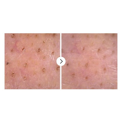 NUMBUZIN No.1 Easy Peasy Cleansing OilCleansing OilGlam Secret