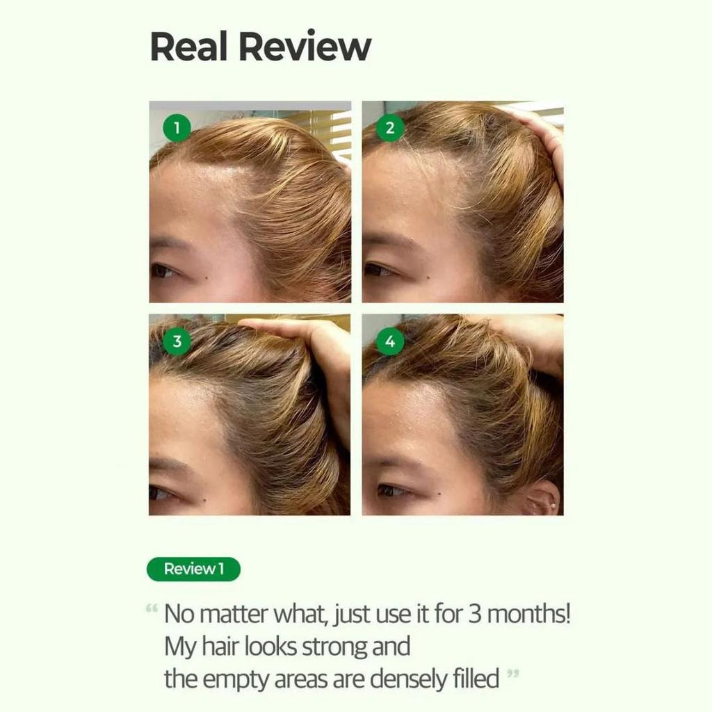 Some By Mi Cica Peptide Anti-Hair Loss Derma Scalp ShampooshampooGlam Secret